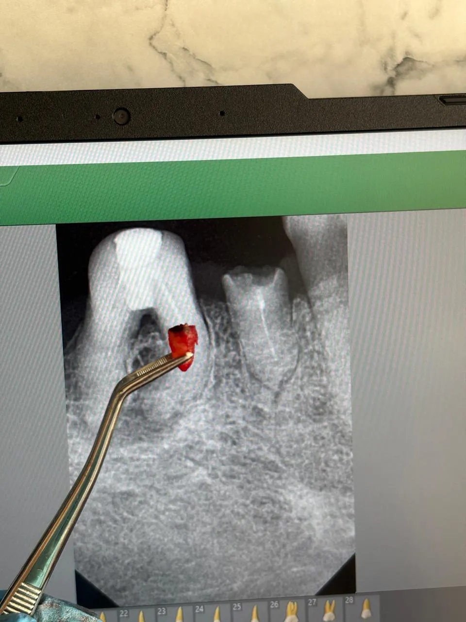 Analyse radiographique au cabinet dentaire